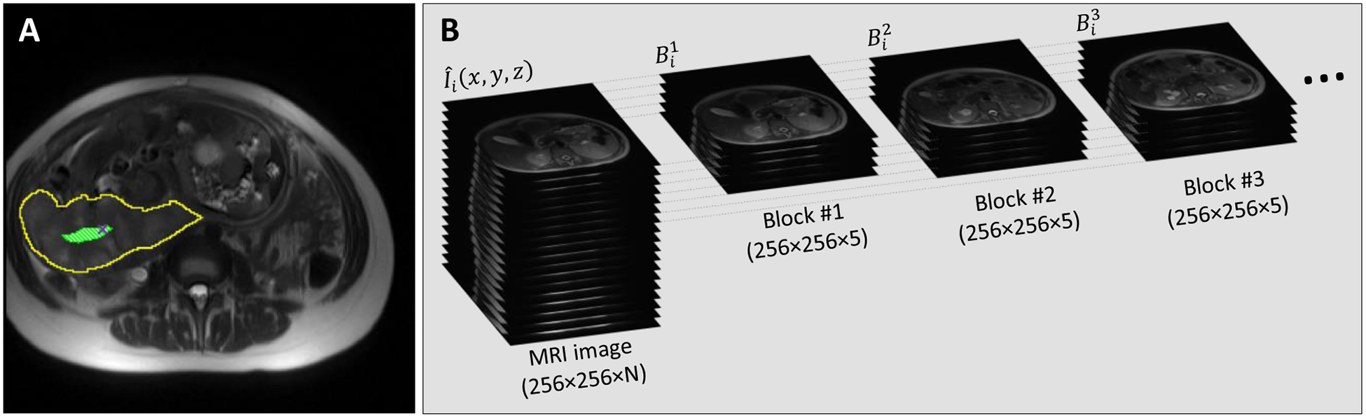 Figure1.