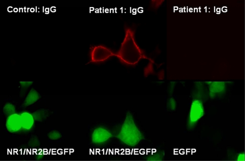 Fig. 1