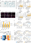 Figure 3. TIS after INX-315 treatment of CCNE1-amplified cancers. A, Left, representative images after staining OVCAR3 and MKN1 cells for beta-galactosidase activity after treatment with INX-315 (scale bar = 100 µm). Experiments performed with three technical replicates. Right, quantification of integrated beta-galactosidase signal per cell. Dashed line indicates cutoff used to define beta-galactosidase positivity, and numbers represent percentage of beta-galactosidase–positive cells. B, Left, representative images after staining OVCAR3 and MKN1 cells with DAPI and phalloidin after treatment with INX-315 (scale bar = 100 µm). Right, quantification of relative nuclear size based on DAPI staining. Experiments performed with three technical replicates. C, ssGSEA scores derived from RNA sequencing of OVCAR3 cells treatment with control or INX-315 300 nmol/L for seven days. Scores are calculated for four independent senescence-associated gene sets; three technical replicates. D, GSEA plots derived from RNA-sequencing performed on tumor tissue from experiments in Fig. 2D and E. Normalized enrichment score (NES) and q value (false discovery rate) were calculated as described in Methods (all P values were calculated using unpaired t tests, error bars represent SD). E, ssGSEA scores for four senescence-associated gene signatures were calculated from RNA-sequencing on OV5398 PDX tumor tissue. Heat map shows z-scores for these. Bar plot above shows mean z-score for each sample across all signatures. F, GSEA plots derived from RNA-sequencing performed on tumor tissue from experiments in Fig. 2D and E. NES and q value (false discovery rate) were calculated as described in Methods (all P values were calculated using unpaired t tests, error bars represent SD).