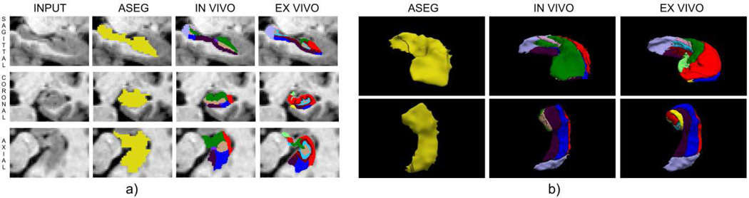 Figure 14