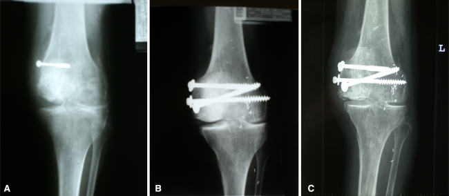 Fig. 1A–C