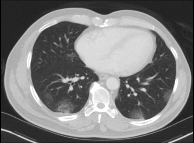 Fig. 2