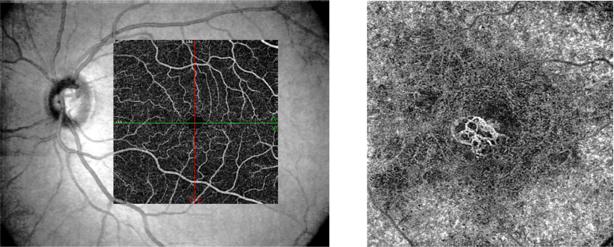 Figure 5: