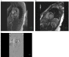 Fig. (2)