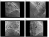 Fig. (3)