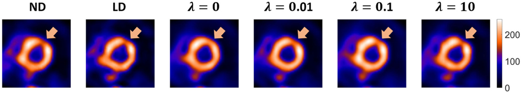 Fig. 11.