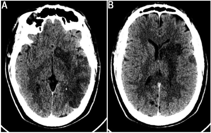 Fig 1