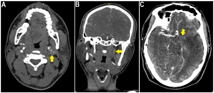 Fig 2