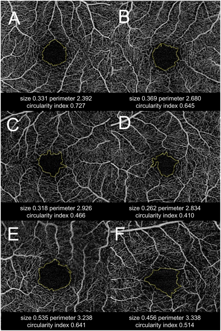 Fig 2