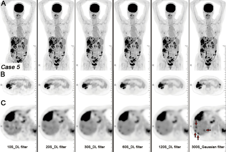 Fig. 5