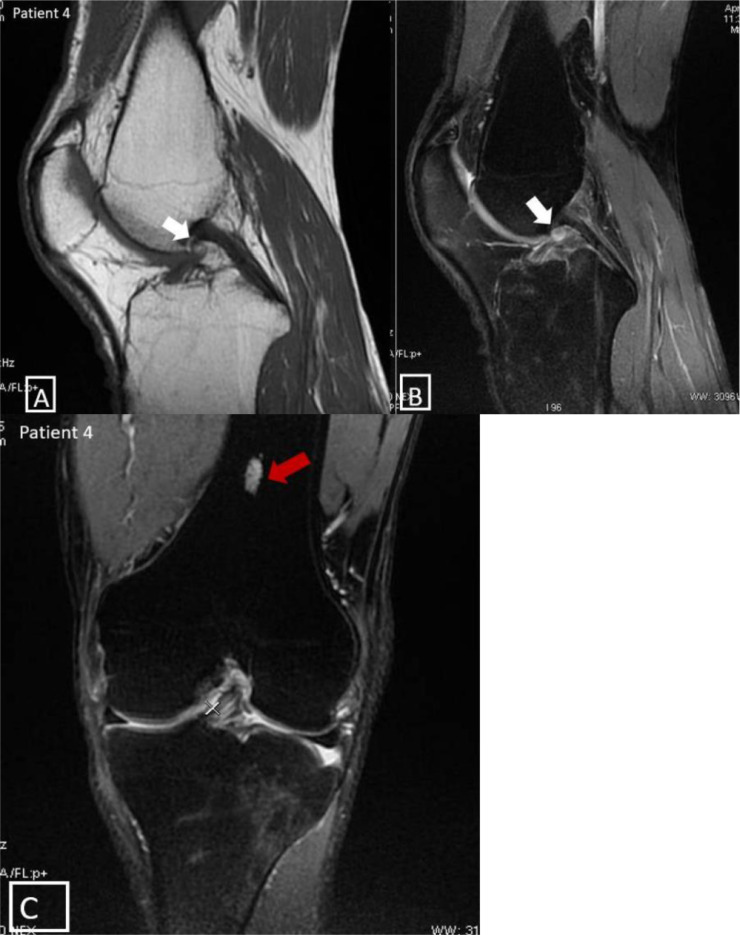 Fig 4