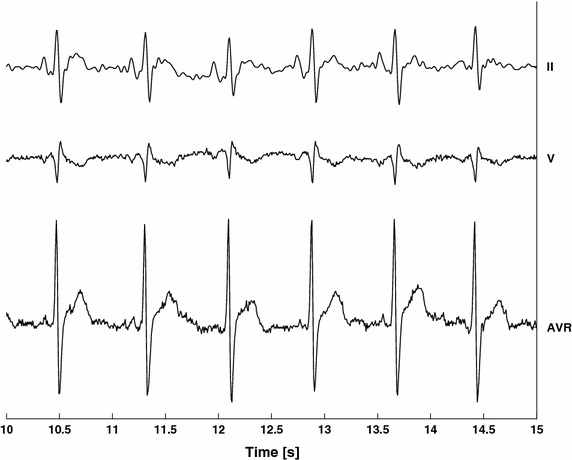 Fig. 2