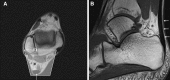Fig. 17