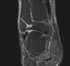 Fig. 16