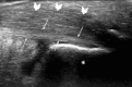 Fig. 20