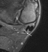 Fig. 13