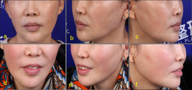 Fig. 6