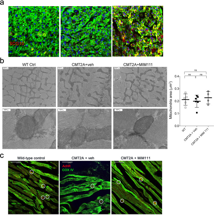 Figure 4—figure supplement 1.