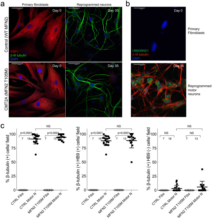 Figure 1—figure supplement 2.