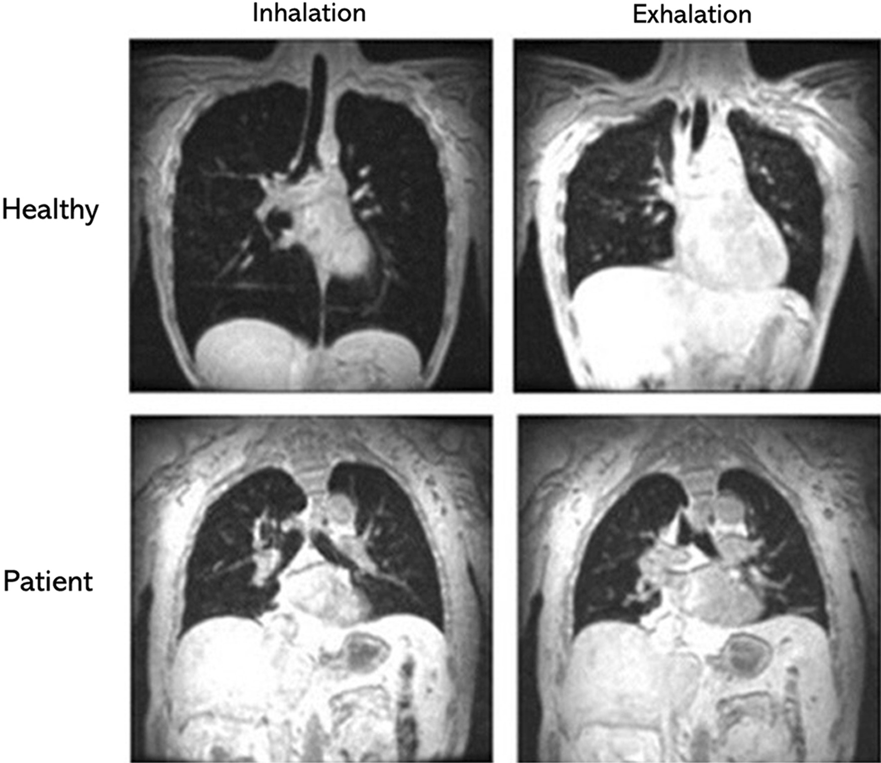 Fig. 13