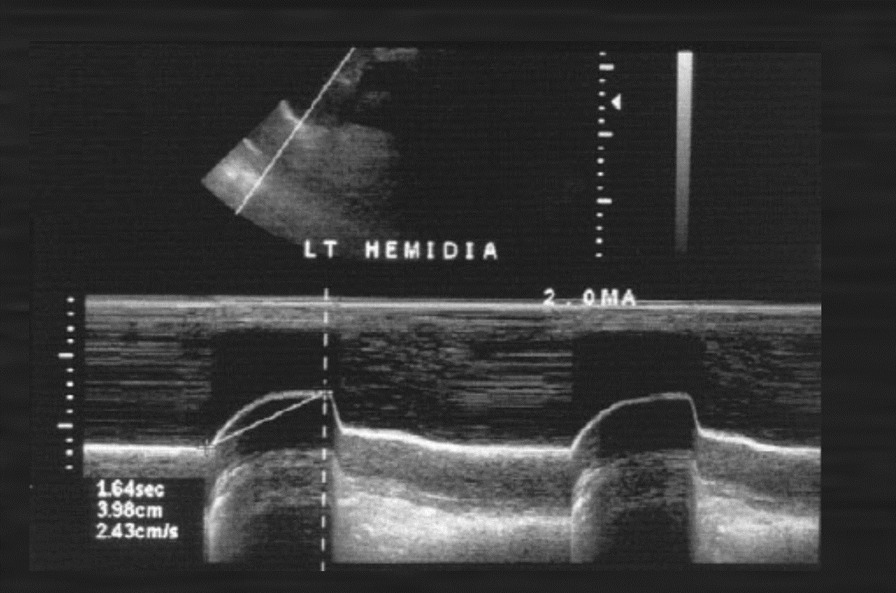 Fig. 27