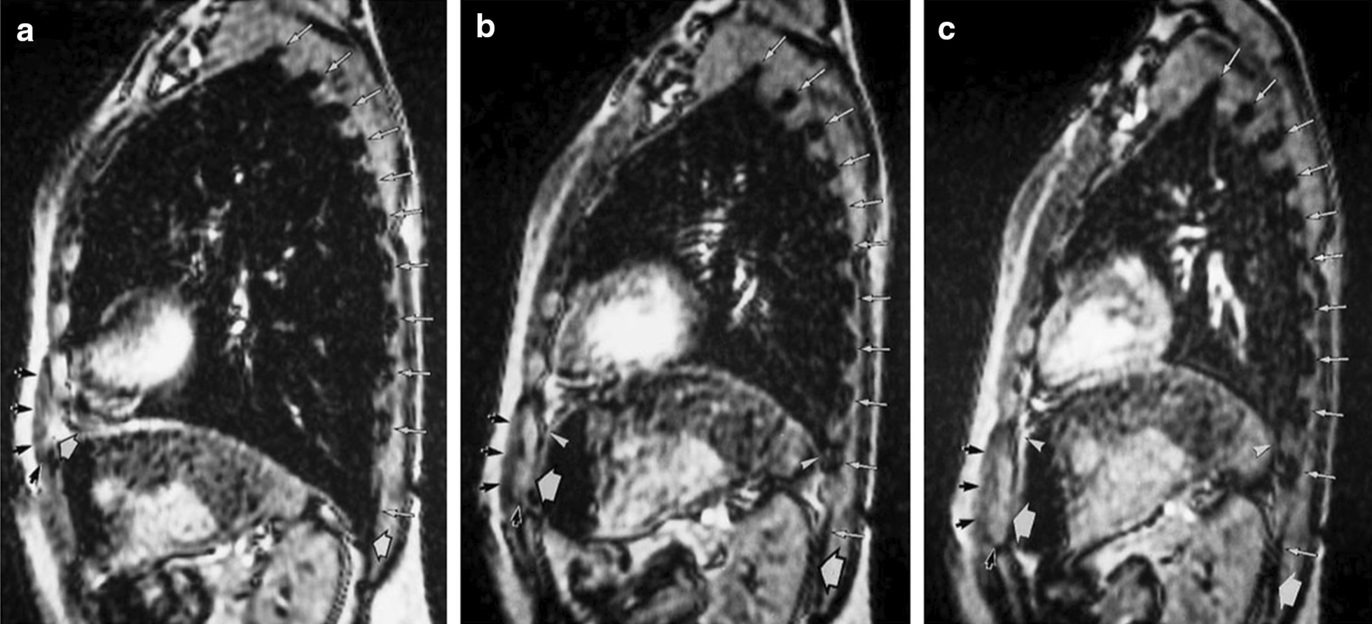 Fig. 12