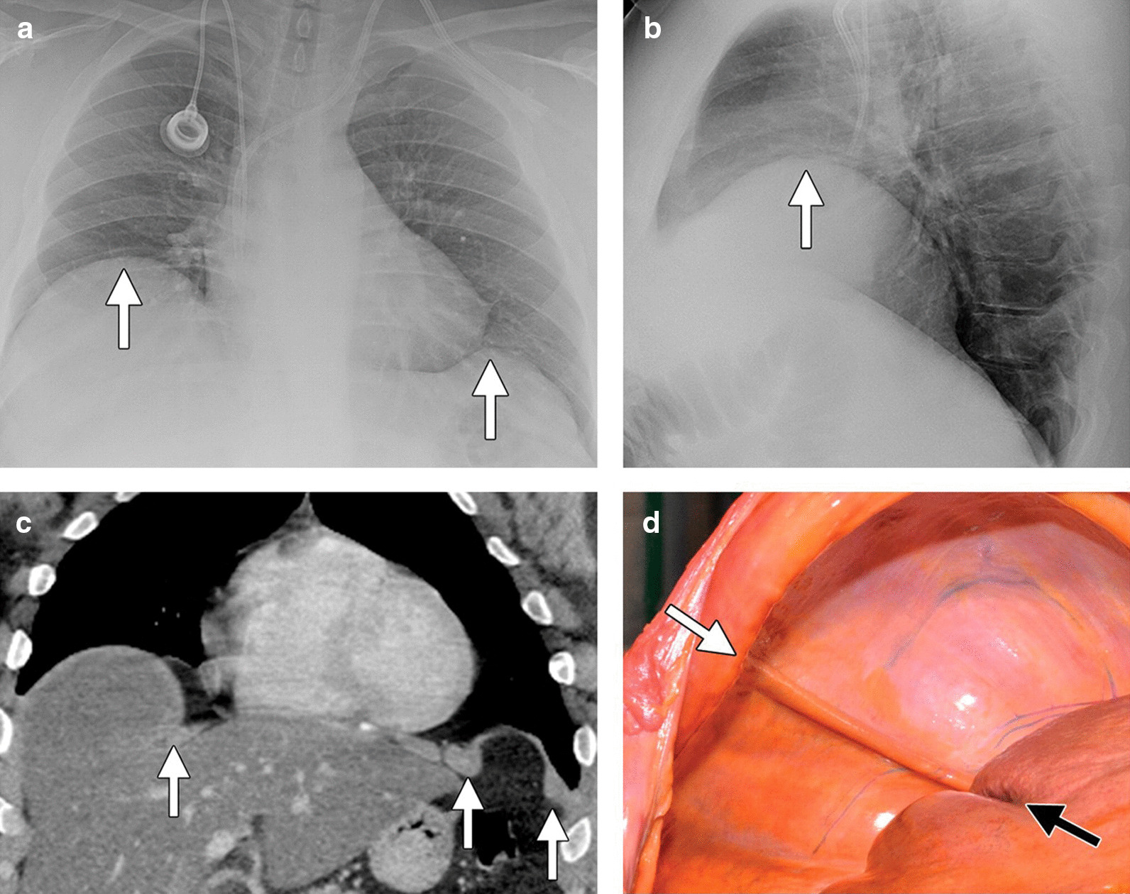 Fig. 23