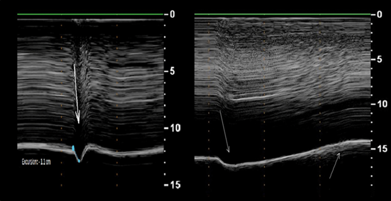 Fig. 18