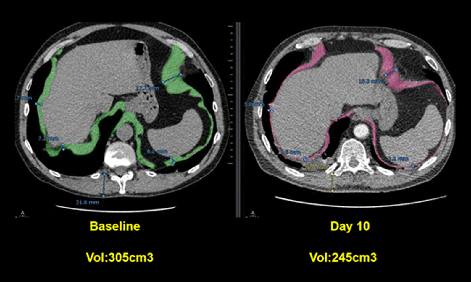 Fig. 11