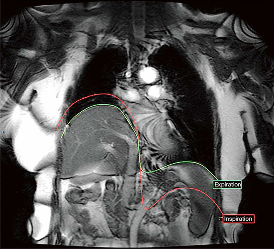 Fig. 24