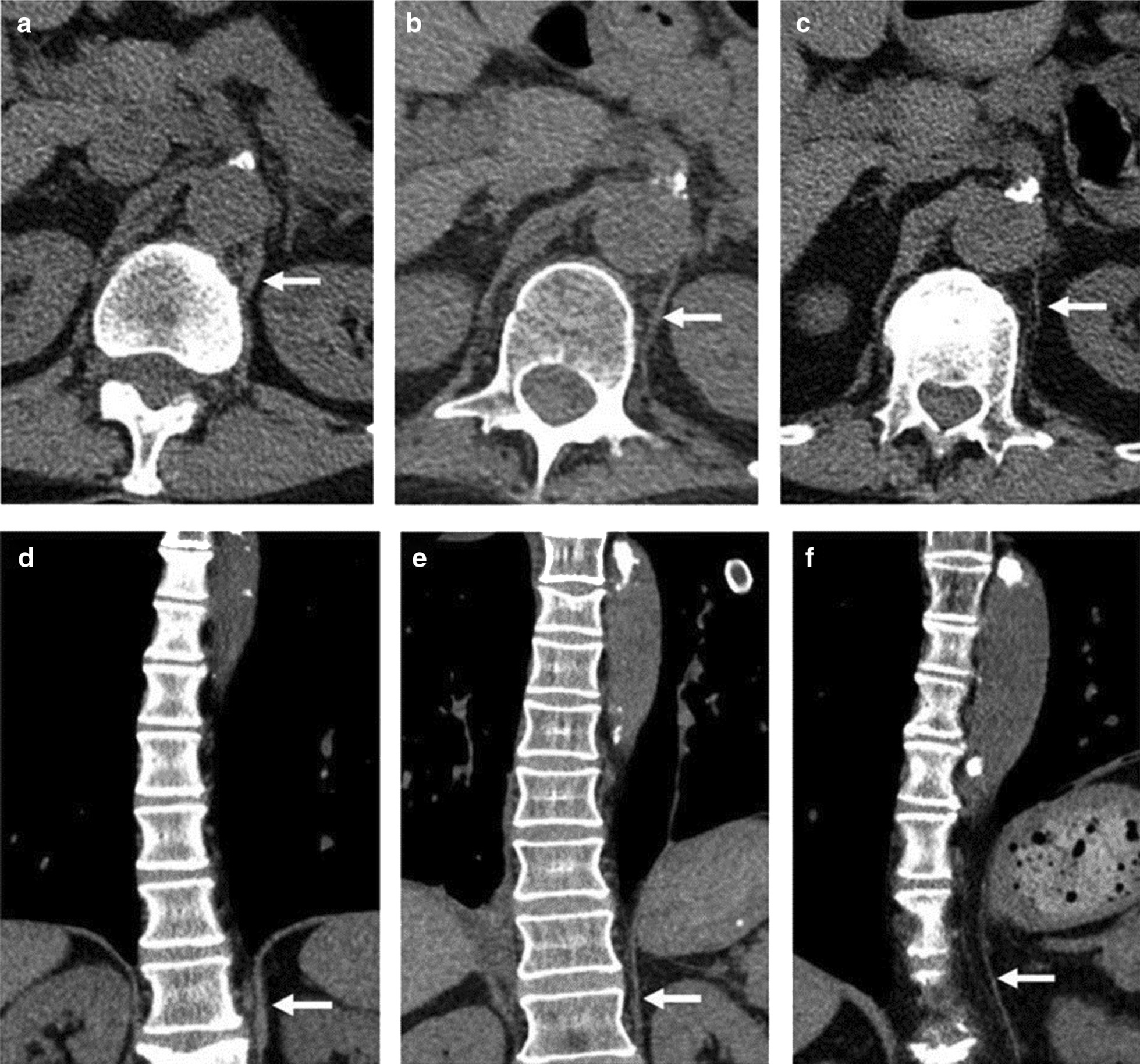 Fig. 21