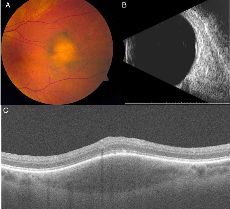 Figure 3