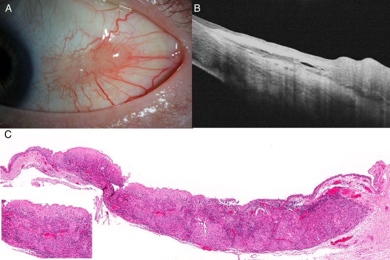 Figure 1