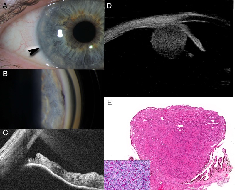 Figure 2