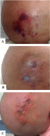Fig. 3
