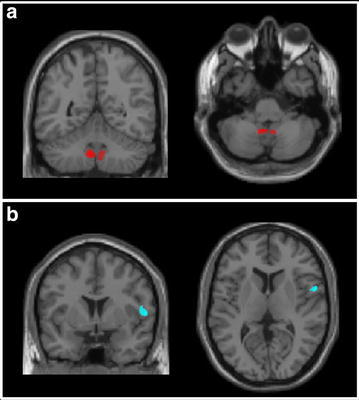 Fig. 3