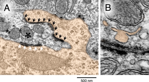 FIG. 10