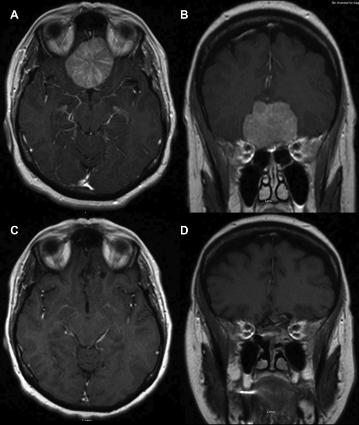 Figure 1