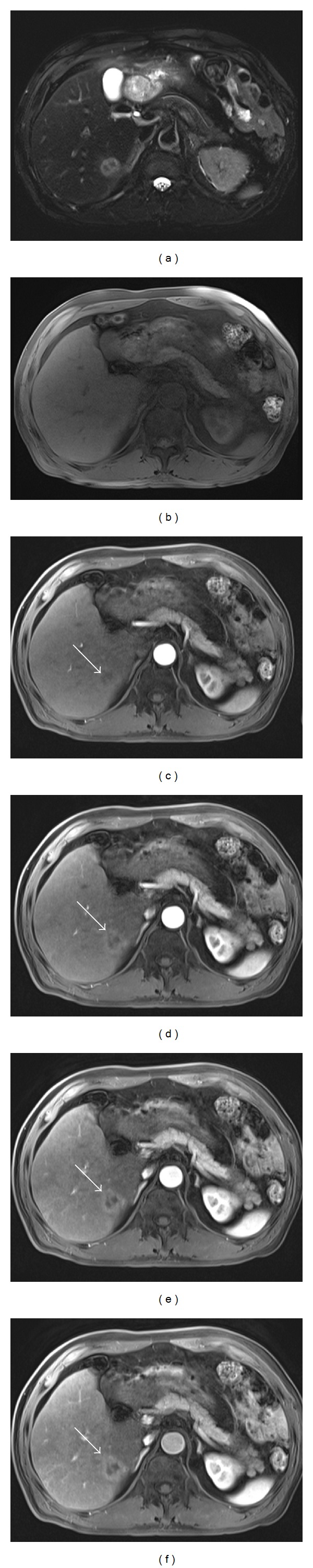 Figure 9