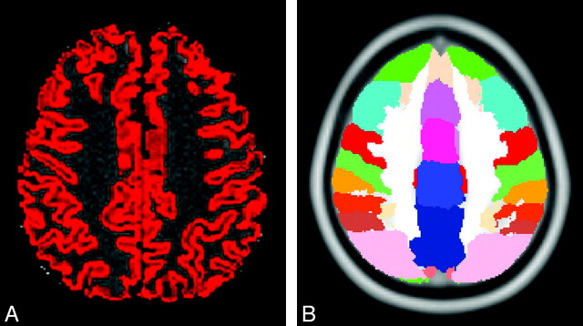 Fig 1.