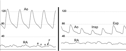 FIGURE 11.