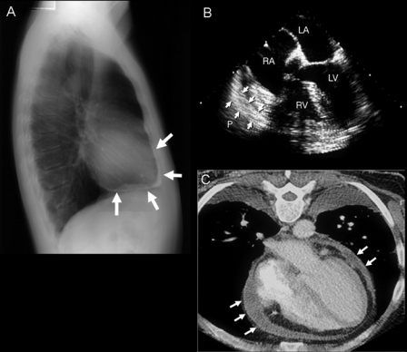 FIGURE 14.