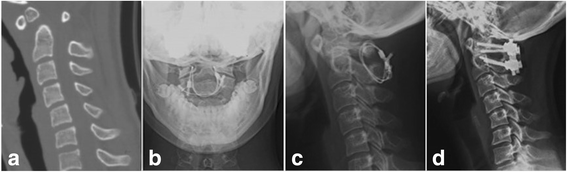 Fig. 5