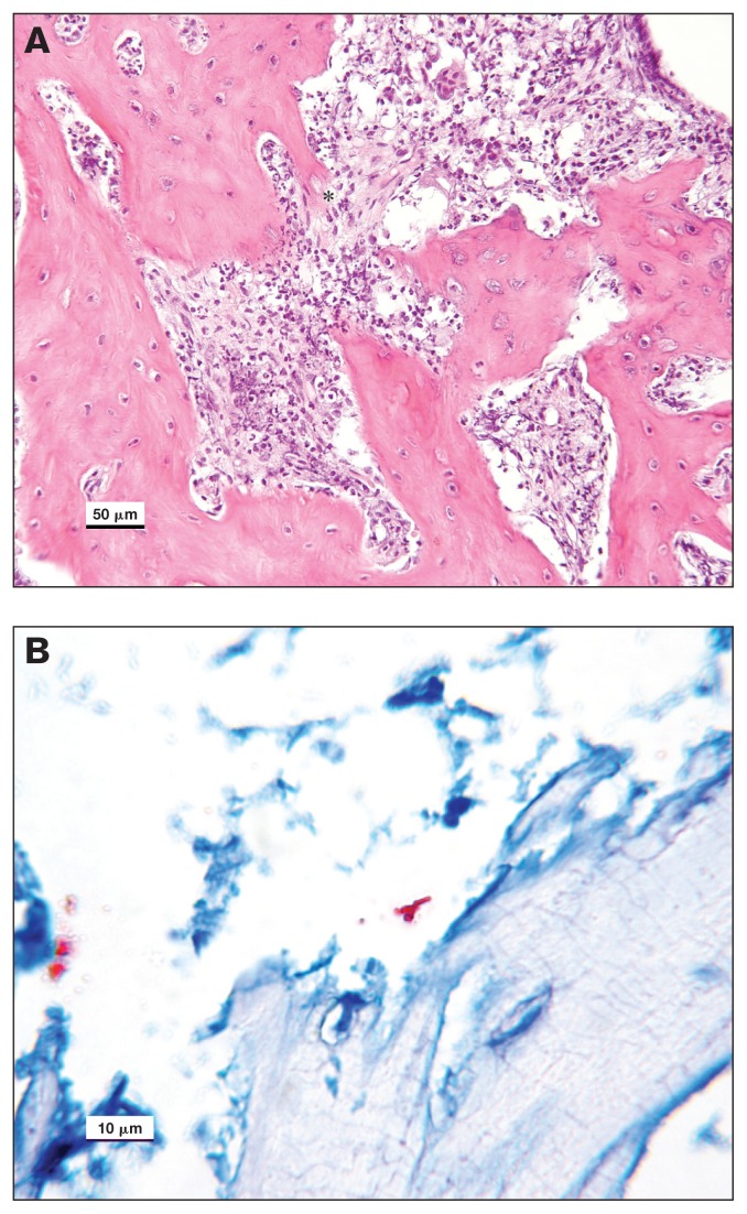 Osteomyelitis associated with Nocardiopsis composta in a dog - PMC