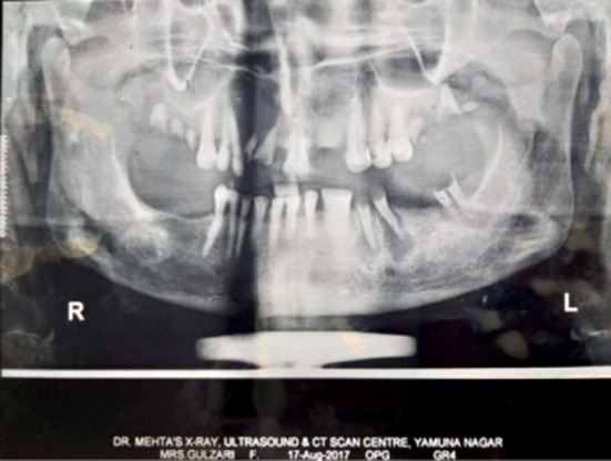 Fig. 2