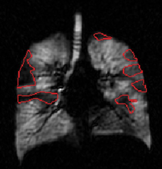 Figure 2c: