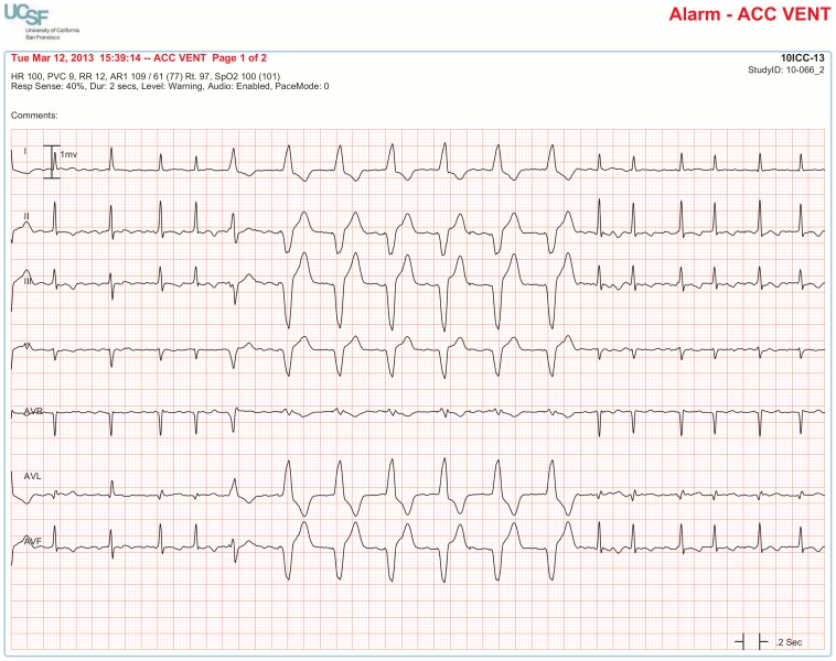 Figure 13