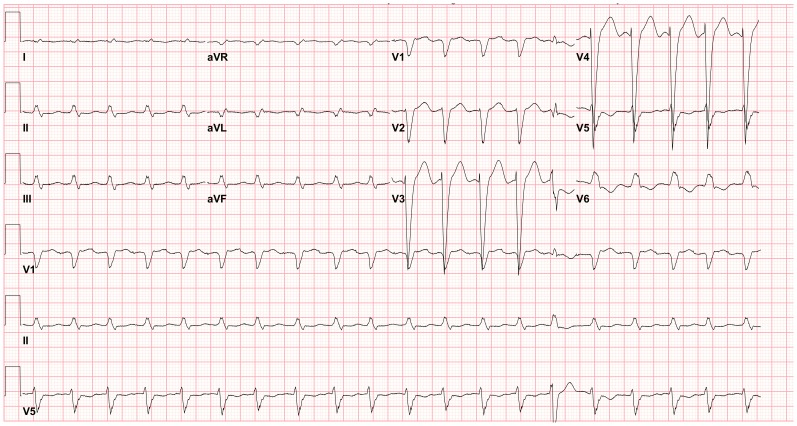 Figure 14