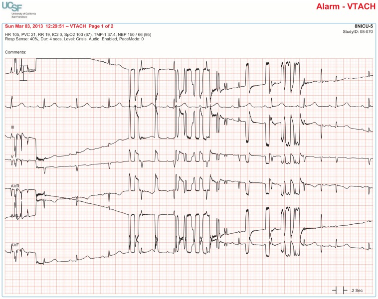 Figure 16