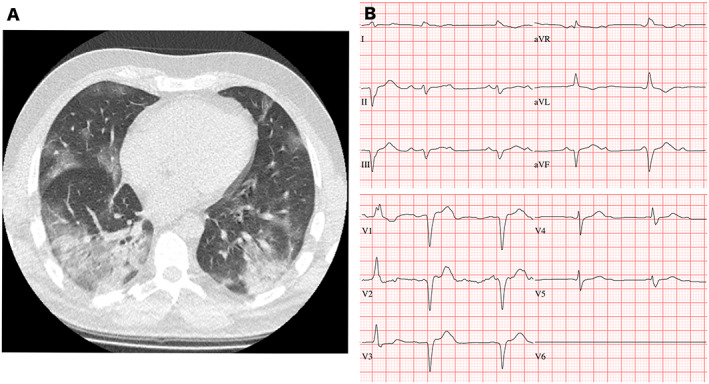 FIGURE 1